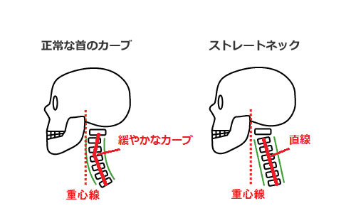 首のカーブにはストレートネック矯正枕