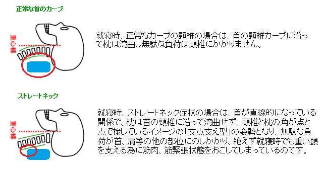 睡眠時におけるストレートネックの矯正にストレートネック矯正枕